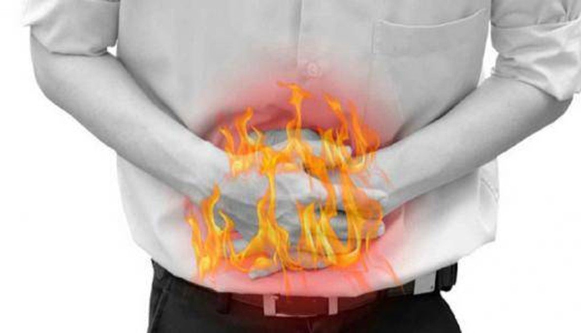 اعراض حموضة المعدة