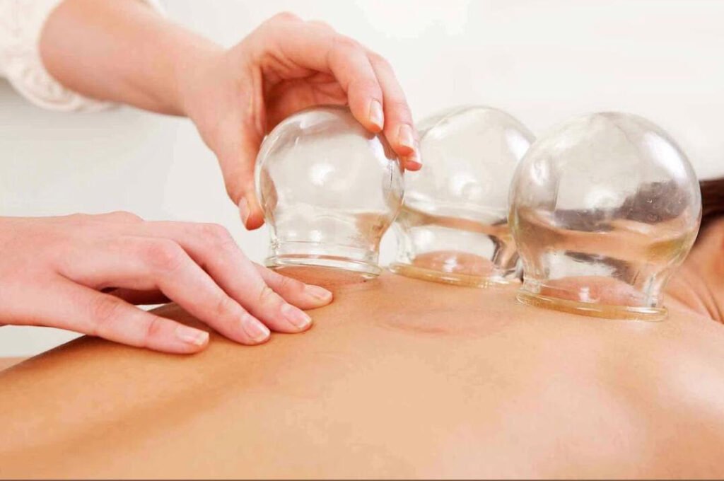 أعراض ما بعد الحجامة