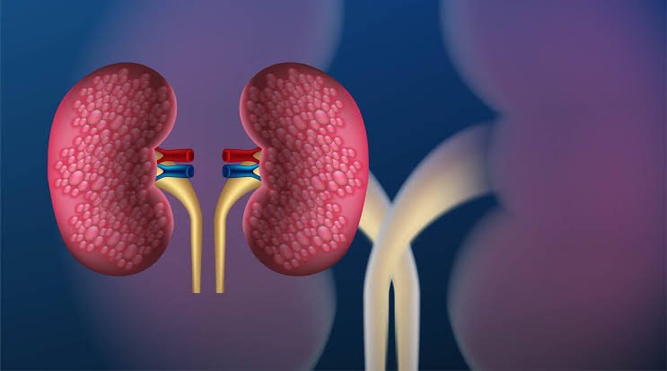 أعراض التهاب كلى